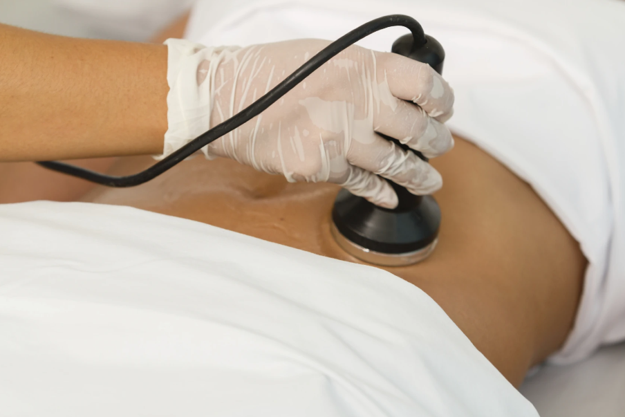 روش غیرتهاجمی برای لاغری